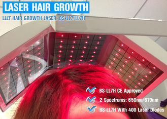 Klinika laserowa 300 watów do leczenia wypadania włosów, laseroterapia niskiego poziomu Wypadanie włosów bezboleśnie
