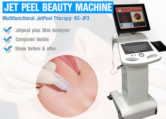 OEM Water Oxygen Jet Peel Oxygen, maszyna do odmładzania skóry do peelingu twarzy