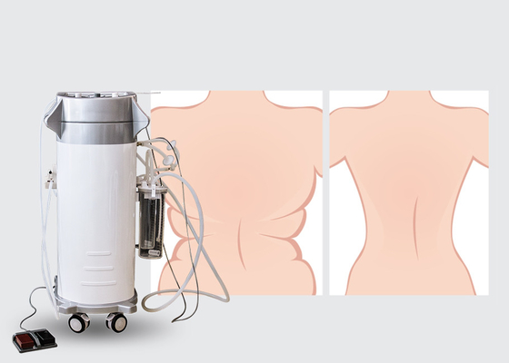 Sprzęt do liposukcji z pomniejszonym poziomem hałasu w kształcie ciała dla szpitali