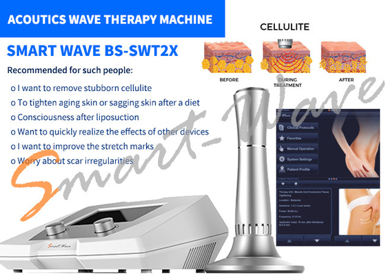 Salon piękności BS-SWT2X Maszyna do terapii falą akustyczną Usuwanie cellulitu 1 rok gwarancji