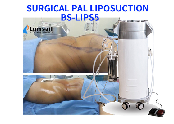 PAL Ultradźwiękowa chirurgiczna maszyna do liposukcji Wyszczuplający sprzęt kosmetyczny z zestawem kaniuli
