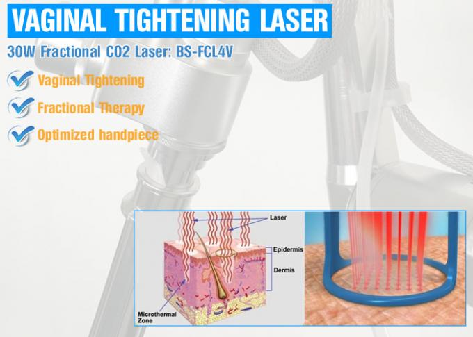 Usuwanie blizny Beauty co2 laser pochwy zaostrzenie produktu usuwanie zmarszczek co2 laserowe dokręcanie pochwy
