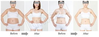 Redukcja tkanki tłuszczowej z ultradźwiękową kawitacją ciała / sprzęt do odsysania tłuszczu