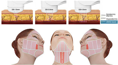 Maszyna do odmładzania skóry HIFU Maszyna do liftingu twarzy z nieinwazyjną technologią