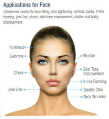 Napinanie skóry HIFU Beauty Machine Terapia ultradźwiękowa o wysokiej intensywności dla urody