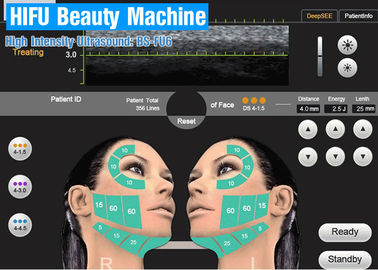 Wysokojakościowa skoncentrowana ultradźwiękowa maszyna kosmetyczna HIFU do zabiegów na twarz w salonie kosmetycznym