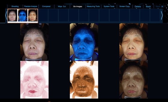 6 Widmo Zobacz więcej Sprzęt do analizy wyraźnej skóry twarzy