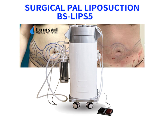 BS-LIPS5 Sprzęt wspomagający liposukcję 300 W do piersi i podbródka szyi