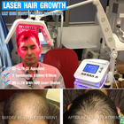 650nm Vertical Diode Laser Equipment For Hair Regrowth
